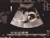 4/27/10: 20 Weeks