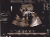 6/22/10: 28 Weeks