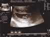 2/2/10: 8 Weeks